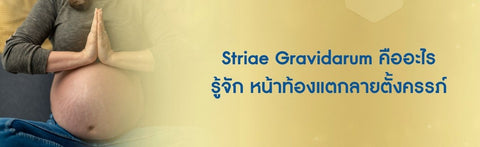 Striae Gravidarum คืออะไร รู้จักหน้าท้องแตกลายตั้งครรภ์