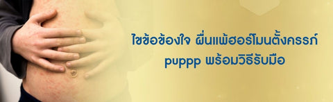 ไขข้อข้องใจ ผื่นแพ้ฮอร์โมนตั้งครรภ์ puppp พร้อมวิธีรับมือ